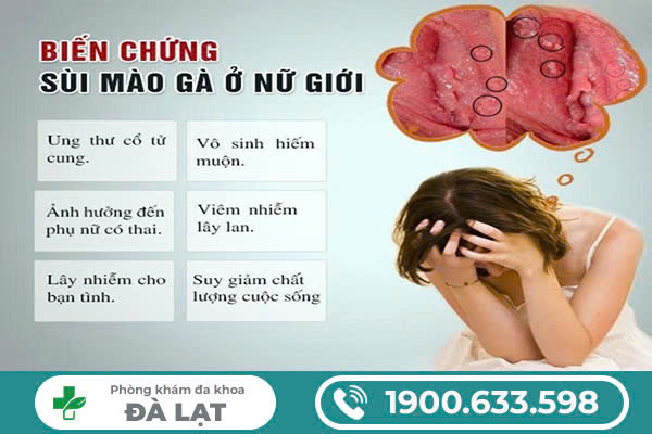 Hình ảnh minh họa